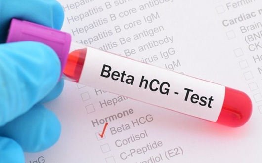 HCG Testi Nedir?