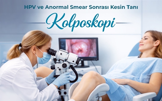Kolposkopi İstanbul